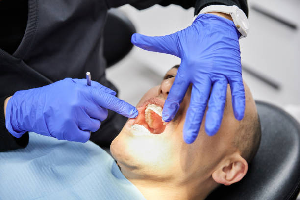 Best Emergency Dental Care for Broken or Chipped Teeth in Hamilton City, CA