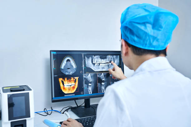 Best Emergency Tooth Extraction in Hamilton City, CA