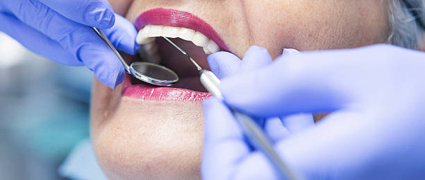 Best Urgent Care for Lost Fillings or Crowns in Hamilton City, CA